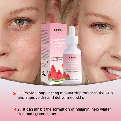 Watermelon Nicotinamide 30ml Care Solution