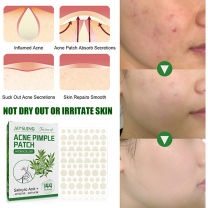 Invisible Makeup, Waterproof, Moisturizing And Cleaning Tea Tree Oil Acne Patch
