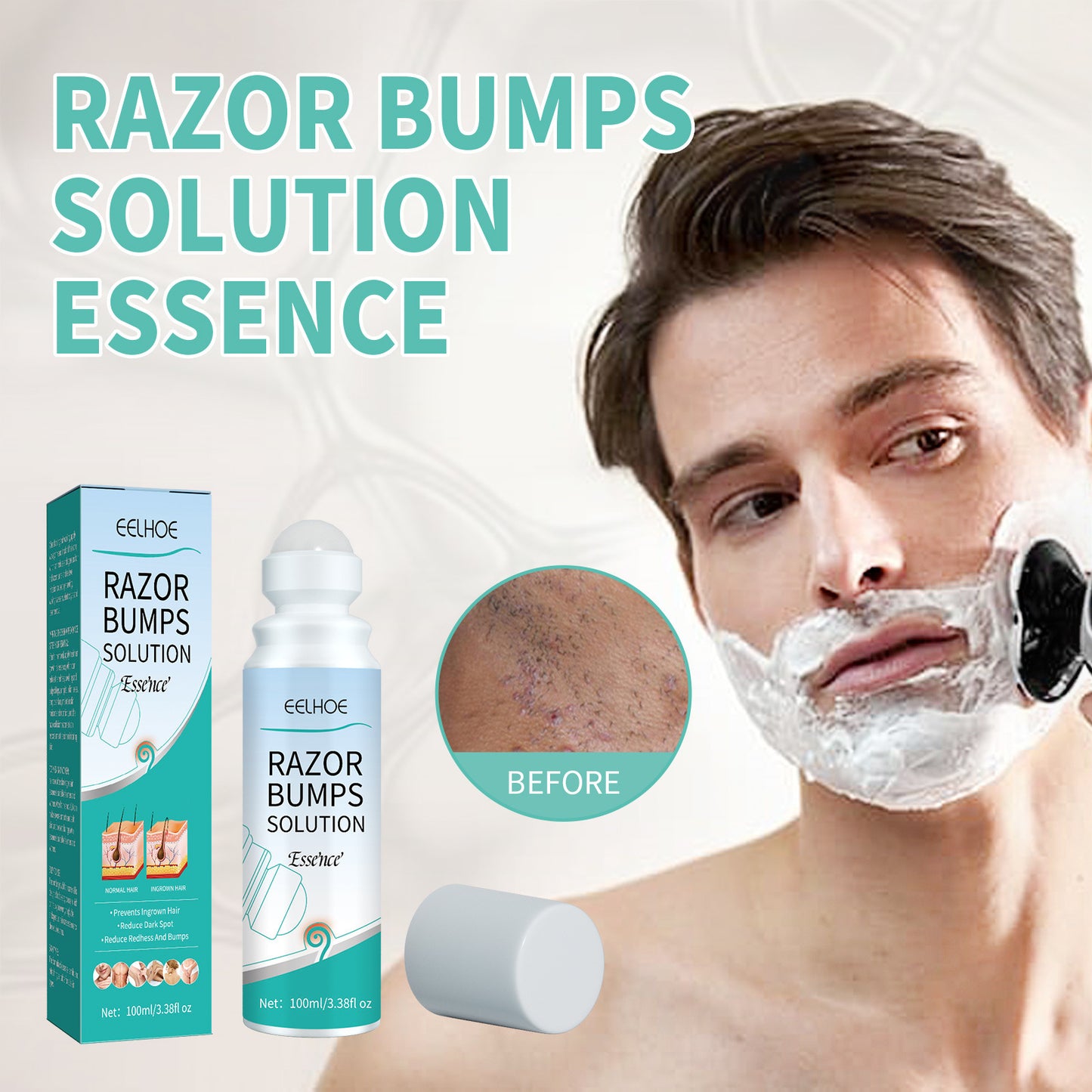 Pogonotomy Lump Repair Ball Repair Skin Pimple Prevent Hair Ingrowth