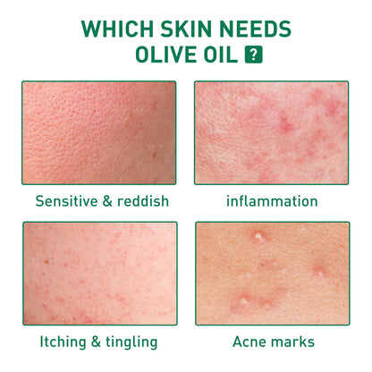 Tea Tree Oil Facial Skin Cleaning And Repair
