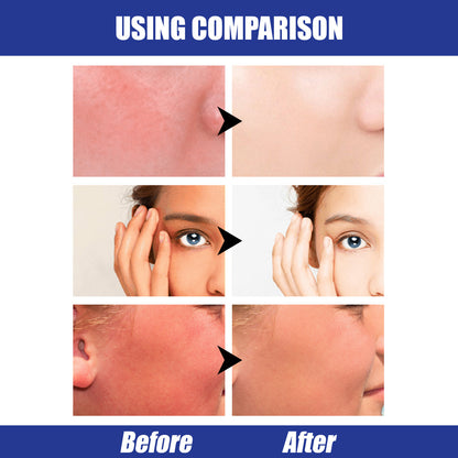 Hyaluronic Acid Moisturizing Lightweight Moisturizing Isolation Waterproof UV Protection SPF50