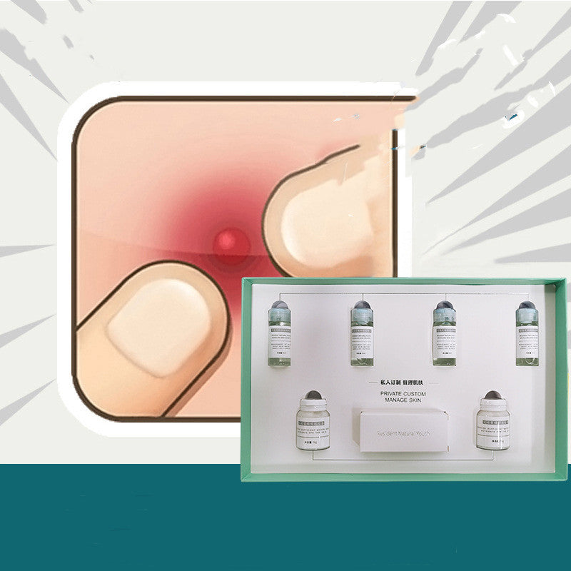 Acne Cream To Remove Pimples And Acne Pits Combination Set