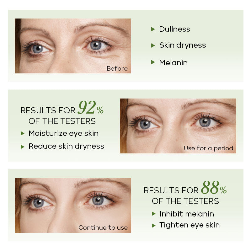 Green Tea Eye Essence 15ml Moisturizing And Caring Skin Around Eyes