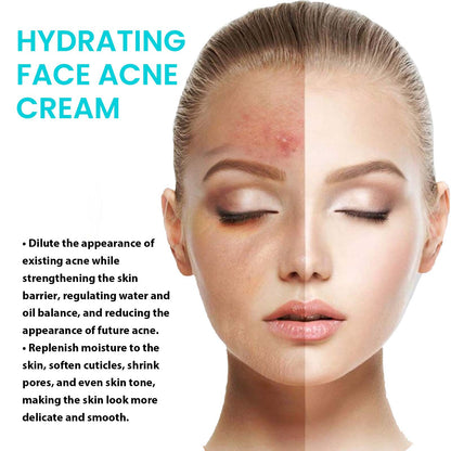 Desalting Pimple Moisturizing Delicate Skin Lightening Cream