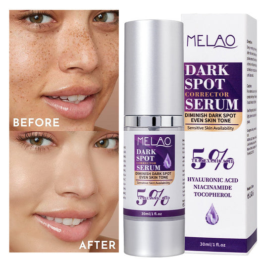 Brightening White Light Spot Tranexamic Acid Solution Brightening Skin Color