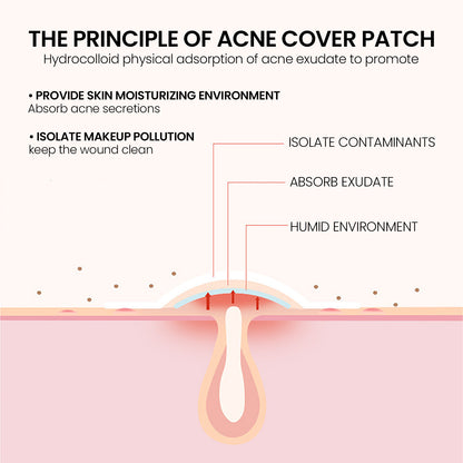 Repair Acne Patch,200patches